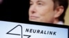Компанія Маска Neuralink вперше вживила чип у мозок людини