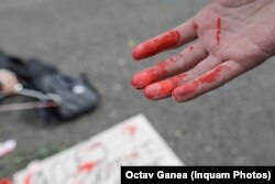 Pentru că avortul a fost interzis în România în 1966 și legea a fost abrogată abia după Revoluție, femeile din România știu ce înseamnă să întrerupi sarcina în condiții improprii.