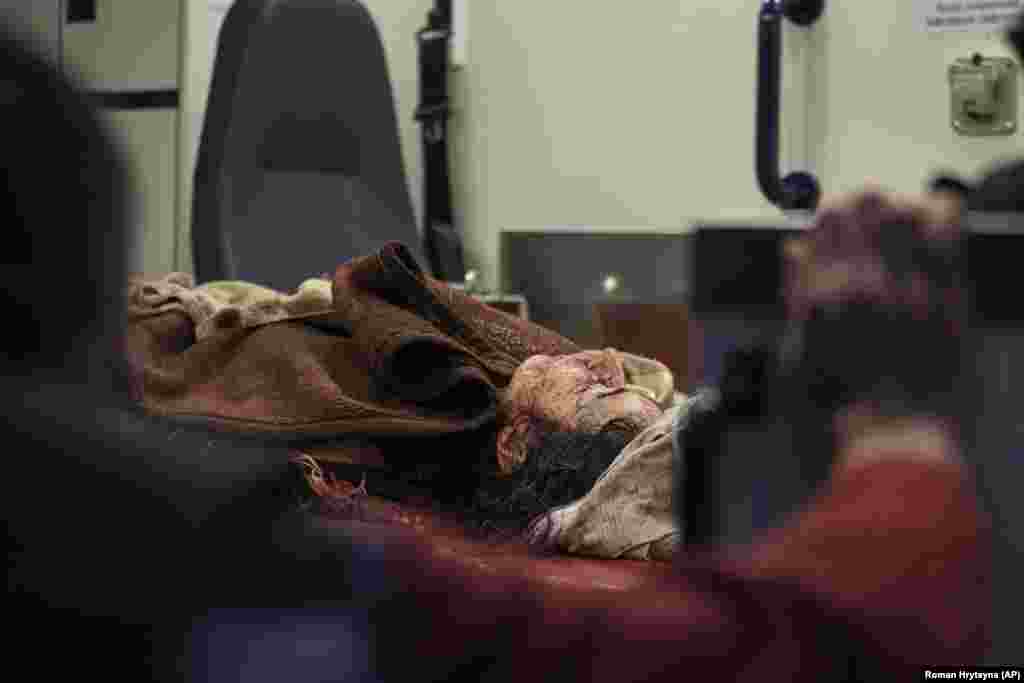 A woman injured during the drone strike on the Kyiv apartment building lies in an ambulance.