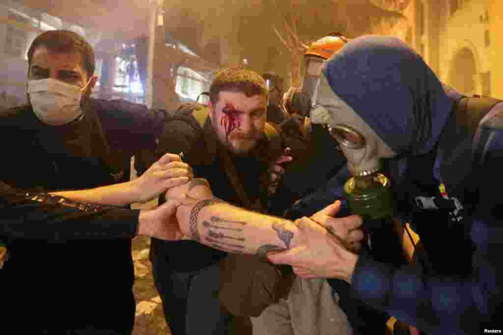 Protesters help an injured man during a rally in Tbilisi. At least 11 people, including six police officers, were receiving hospital treatment after being injured, according to Georgia's Health Ministry. 