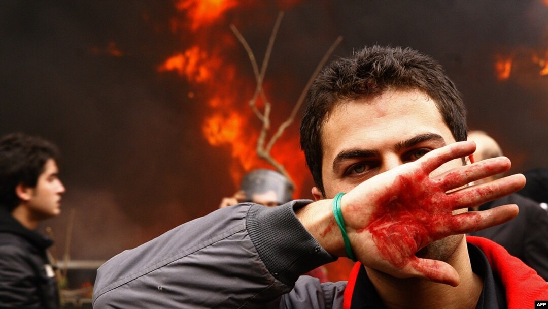 An Iranian opposition protester covers his face with his bloodstained hand during clashes with security forces in Tehran on December 27.