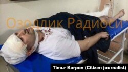 Госпитализированный после избиения блогер Миразиз Базаров.