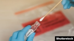 Na Kosovu nijedna privatna klinika ili laboratorija nema dozvolu nadležnih institucija za sprovođenje PCR testiranja