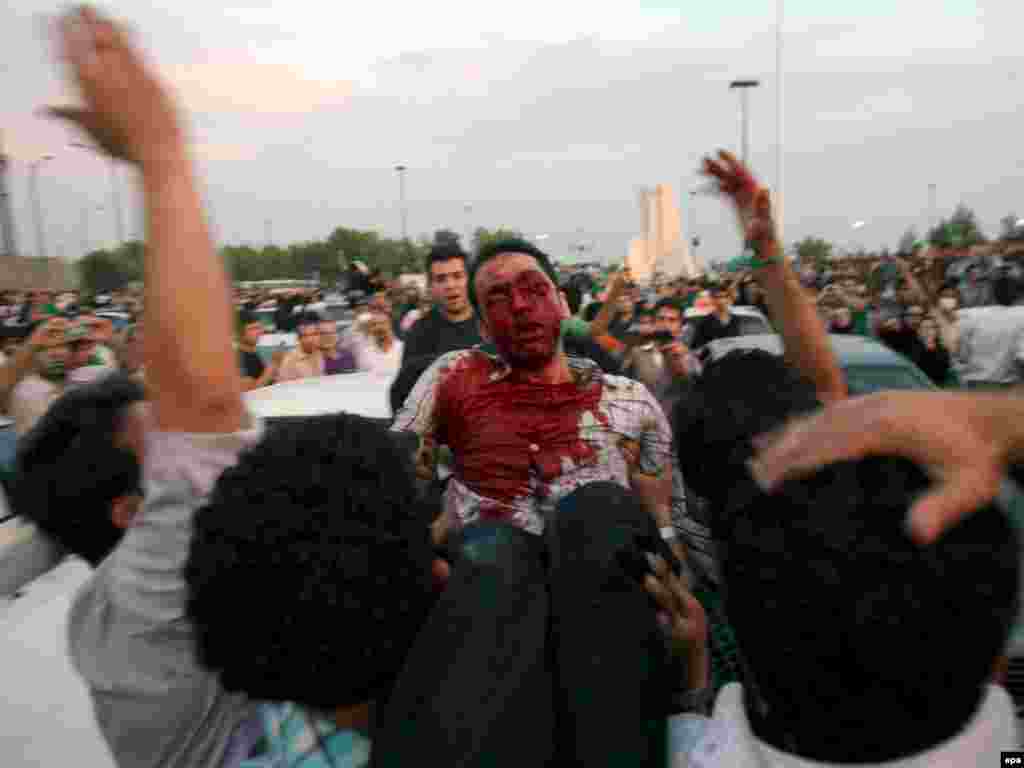 Demonstrators carry a seriously wounded man out of the fray.