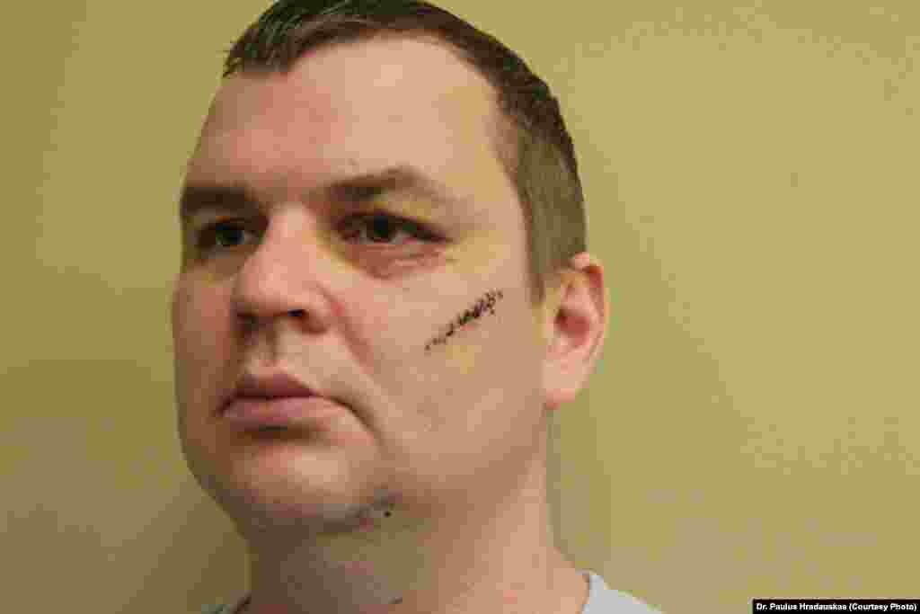 Bulatov said that, after he was abandoned in freezing temperatures on the night of January 30, he managed to walk to a nearby village where he telephoned friends who took him back to Kyiv.