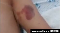 30 май куни Андижонда қийноққа тутилган 32 ёшли Алижон Абдукаримов 11 июнь куни жон таслим қилганди.