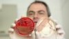Профессор Гельмут Фикеншер: сальмонелланын бактериясы антибиотиктерди тоотпой калган, Киель, Германия, 01.06.2011.