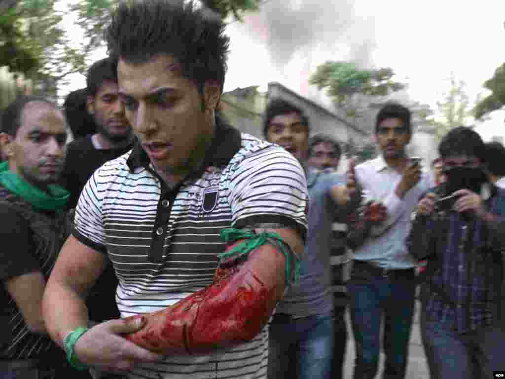 Iranian media reported that seven people were killed in the clashes. This demonstrator suffered a gunshot wound.