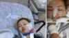 Соцсети нашли родных кыргызстанки, оказавшейся между жизнью и смертью в Турции 