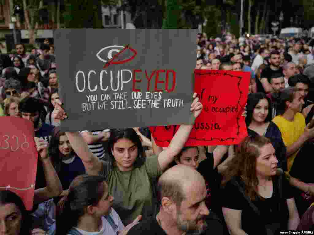 A protester holds a sign in reference to demonstrators who lost their eyes in violence or were temporarily blinded by tear gas during clashes with police on June 20. Police used rubber bullets and tear gas against the crowd, with hundreds of people being injured, including many police. 