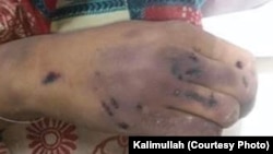 ۲۷ کلنه بي بي عارفه په توبه کې په وهلو ټکولو وژل شوې